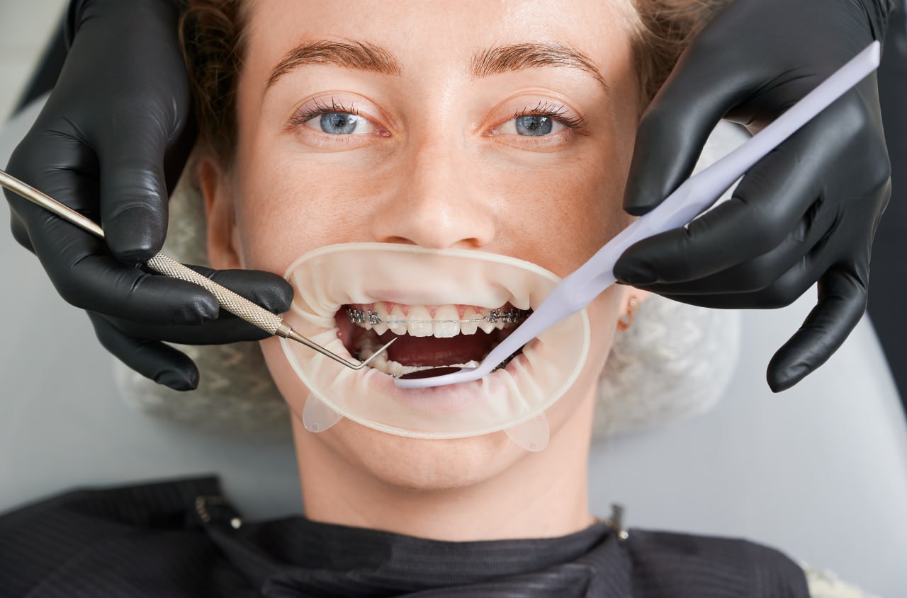 Professional Diploma in Orthodontics